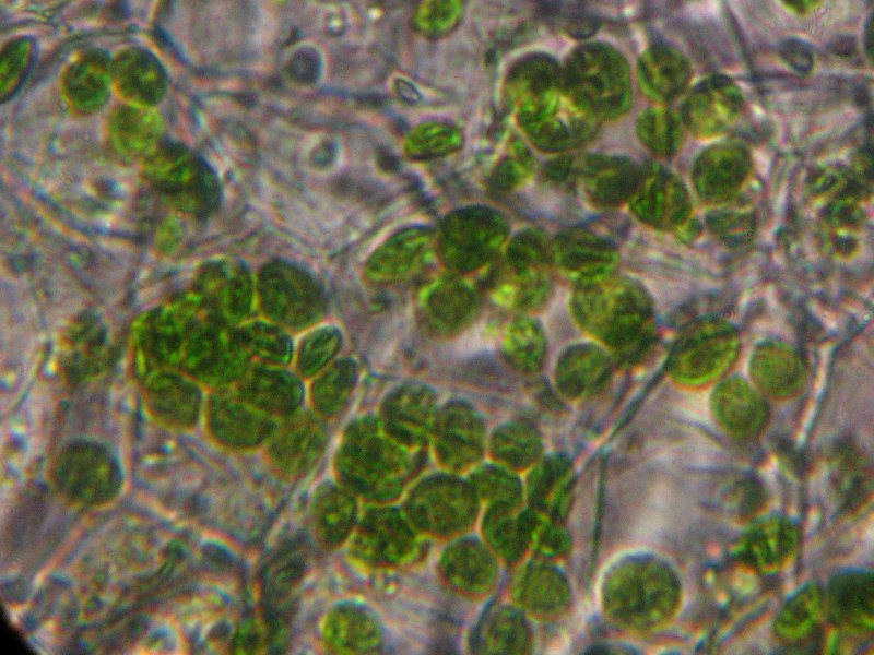 histo2.jpg, 56 kB