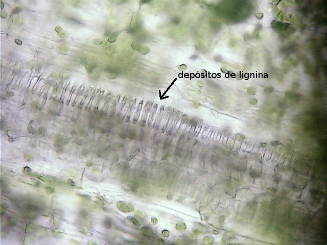 Xilema